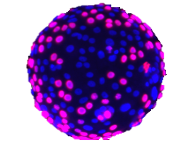 Luna Therapeutics Ltd